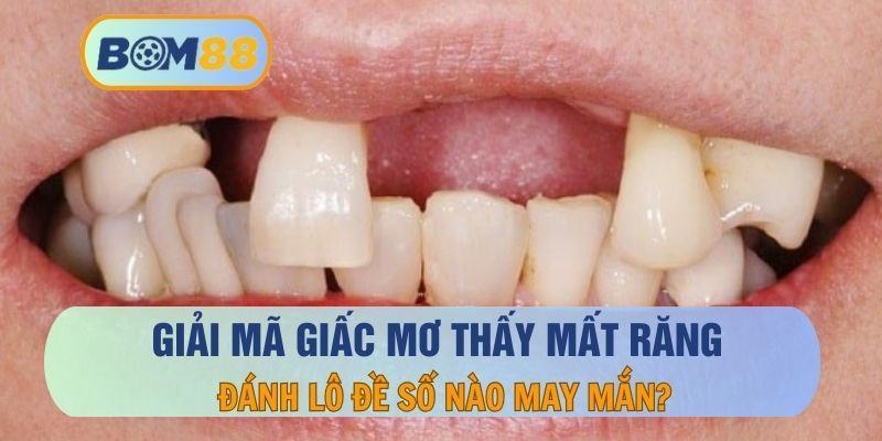 BOM88 Mơ thấy mất răng đánh con gì dễ trúng lô ? Giải mã giấc mơ cùng BOM88